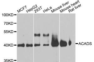 Western blot analysis of extracts of various cell lines, using ACADS antibody (ABIN5970342) at 1/1000 dilution. (ACADS Antikörper)