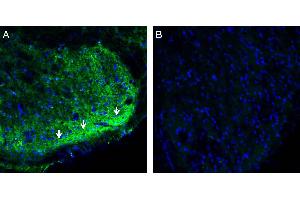 Expression of CRMP2 in rat spinal cord. (DPYSL2 Antikörper  (Intracellular))