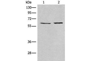 Western blot analysis of A172 and Jurkat cell lysates using USP14 Polyclonal Antibody at dilution of 1:400 (USP14 Antikörper)