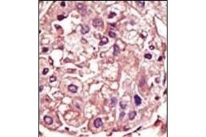Immunohistochemistry (Paraffin-embedded Sections) (IHC (p)) image for anti-Transforming Growth Factor, beta Receptor 1 (TGFBR1) (AA 134-163) antibody (ABIN392279)