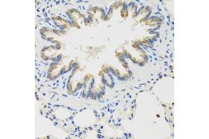 Immunohistochemistry of paraffin-embedded rat lung using TICAM1 antibody (ABIN6292306) at dilution of 1:100 (40x lens).