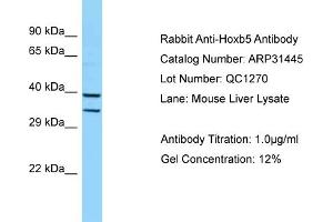 Western Blotting (WB) image for anti-Homeobox B5 (HOXB5) (Middle Region) antibody (ABIN2777304) (HOXB5 Antikörper  (Middle Region))