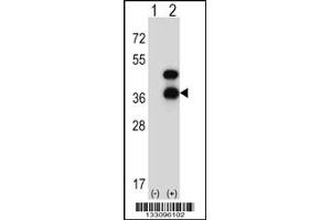 Western blot analysis of CD72 using rabbit polyclonal CD72 Antibody using 293 cell lysates (2 ug/lane) either nontransfected (Lane 1) or transiently transfected (Lane 2) with the CD72 gene. (CD72 Antikörper  (AA 176-203))