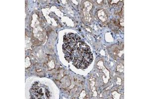 Immunohistochemical staining (Formalin-fixed paraffin-embedded sections) of human kidney with DYSF polyclonal antibody  shows strong positivity in the glomeruli and moderate membranous staining in tubular cells. (Dysferlin Antikörper)