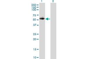 Western Blot analysis of PPP2R2C expression in transfected 293T cell line by PPP2R2C monoclonal antibody (M01), clone 6D1. (PPP2R2C Antikörper  (AA 1-110))