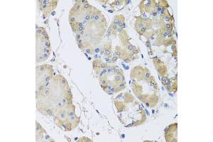 Immunohistochemistry of paraffin-embedded human stomach using RPLP1 antibody (ABIN5974064) at dilution of 1/100 (40x lens).