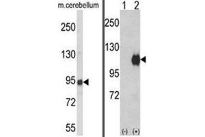 (LEFT) Western blot analysis of ENPP2 Antibody (Center) in mouse cerebellum tissue lysates (35ug/lane). (ENPP2 Antikörper  (Middle Region))