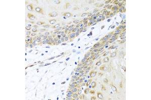 Immunohistochemistry of paraffin-embedded human esophagus using INHBC antibody (ABIN5975306) at dilution of 1/100 (40x lens). (INHBC Antikörper)