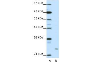 WB Suggested Anti-ZNF253 Antibody Titration:  1. (ZNF253 Antikörper  (C-Term))