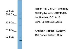 WB Suggested Anti-CYP2R1  Antibody Titration: 0. (CYP2R1 Antikörper  (Middle Region))