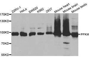 Western blot analysis of extracts of various cell lines, using PFKM antibody (ABIN5973190) at 1/1000 dilution. (PFKM Antikörper)