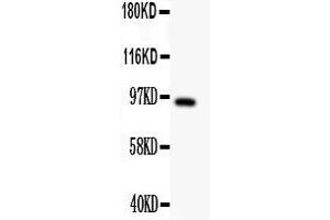 Anti- DISC1 antibody, Western blottingAll lanes: Anti DISC1  at 0. (DISC1 Antikörper  (Middle Region))