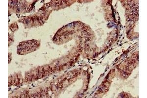 Immunohistochemistry (IHC) image for anti-TAR DNA Binding Protein (TARDBP) (AA 1-396) antibody (ABIN7171509)