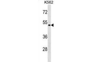 Western Blotting (WB) image for anti-Enolase Superfamily Member 1 (ENOSF1) antibody (ABIN2998739) (ENOSF1 Antikörper)