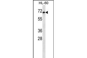HIPK4 Antibody ABIN659185 western blot analysis in HL-60 cell line lysates (35 μg/lane). (HIPK4 Antikörper)