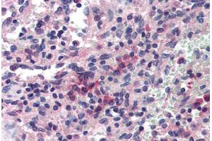 Human Spleen (formalin-fixed, paraffin-embedded) stained with SAE1 antibody ABIN214379 at 5 ug/ml followed by biotinylated goat anti-rabbit IgG secondary antibody ABIN481713, alkaline phosphatase-streptavidin and chromogen. (SAE1 Antikörper)