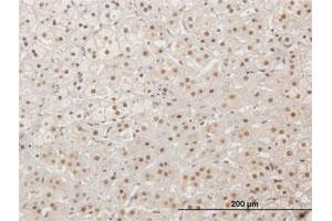 Immunohistochemistry (Formalin-fixed Paraffin-embedded Sections) (IHC (fp)) image for anti-X-Ray Repair Complementing Defective Repair in Chinese Hamster Cells 4 (XRCC4) (AA 1-336) antibody (ABIN1327721)