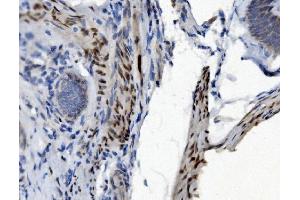 IHC analysis of PTBP2 using anti-PTBP2 antibody (ABIN7599454).