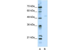 WB Suggested Anti-TFEB Antibody Titration:  2. (TFEB Antikörper  (C-Term))
