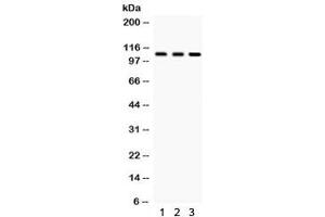 Western blot testing of 1) rat testis, 2) rat brain and 3) human HeLa lysate with CYLD antibody. (CYLD Antikörper  (AA 618-956))