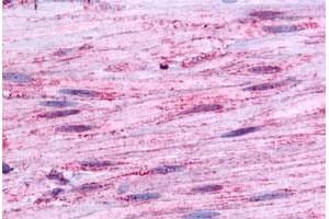 Immunohistochemical staining of human smooth muscle with BDKRB1 polyclonal antibody . (BDKRB1 Antikörper  (Extracellular Domain))