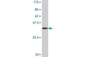 Western Blotting (WB) image for anti-Acid Phosphatase 1, Soluble (ACP1) (AA 1-158) antibody (ABIN513076)