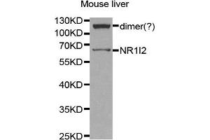 Western Blotting (WB) image for anti-Nuclear Receptor Subfamily 1, Group I, Member 2 (NR1I2) antibody (ABIN1873949) (NR1I2 Antikörper)