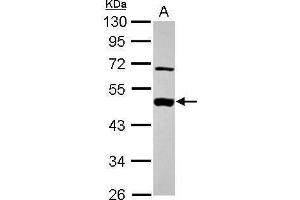 WB Image Sample (30 ug of whole cell lysate) A: A431 , 10% SDS PAGE antibody diluted at 1:1000 (MEK2 Antikörper)