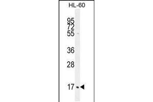 Western blot analysis in HL-60 cell line lysates (35ug/lane). (C1QC Antikörper  (AA 93-120))