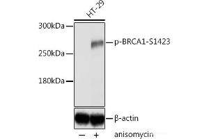 Western blot analysis of extracts of HT-29 cells using Phospho-BRCA1(S1423) Polyclonal Antibody at dilution of 1:2000. (BRCA1 Antikörper  (pSer1423))