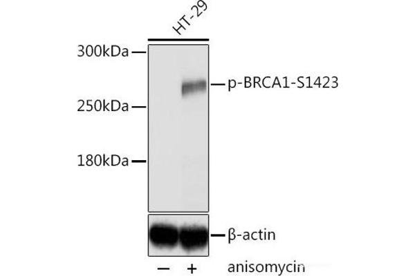 BRCA1 antibody  (pSer1423)