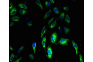 Immunofluorescent analysis of Hela cells using ABIN7147825 at dilution of 1:100 and Alexa Fluor 488-congugated AffiniPure Goat Anti-Rabbit IgG(H+L) (Clarin 3 Antikörper  (AA 39-91))