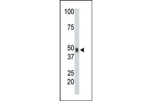 The anti-CHK Pab (ABIN391080 and ABIN2841225) is used in Western blot to detect CHK in mouse heart tissue lysate. (MATK Antikörper  (N-Term))