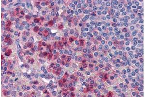 Human Spleen, Neutrophils (formalin-fixed, paraffin-embedded) stained with IL27 antibody ABIN351442 at 5 ug/ml followed by biotinylated goat anti-rabbit IgG secondary antibody ABIN481713, alkaline phosphatase-streptavidin and chromogen. (IL-27 Antikörper  (Internal Region))
