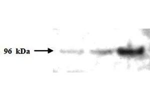 Western Blotting (WB) image for anti-PMS2 Postmeiotic Segregation Increased 2 (S. Cerevisiae) (PMS2) (AA 58-81) antibody (ABIN400795) (PMS2 Antikörper  (AA 58-81))