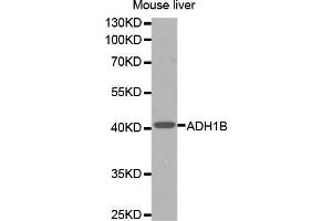 Western Blotting (WB) image for anti-Alcohol Dehydrogenase 1B (Class I), beta Polypeptide (ADH1B) (AA 206-375) antibody (ABIN1678576) (ADH1B Antikörper  (AA 206-375))