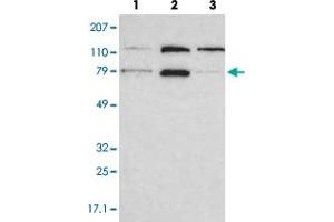 Western blot analysis of lane 1: RT-4, lane 2: EFO-21 and lane 3: A-431 cell lysates using PNN polyclonal antibody . (PNN Antikörper)