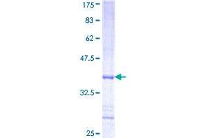 Image no. 1 for Phosphorylase Kinase, alpha 2 (PHKA2) (AA 428-521) protein (GST tag) (ABIN1314919) (PHKA2 Protein (AA 428-521) (GST tag))