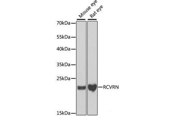 Recoverin Antikörper