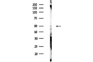 Western blot analysis of lysates from EC304 cells(heat-shock treatment), using Phospho-Tau (Ser404)[Ser721] Antibody at 1/1000 dilution.