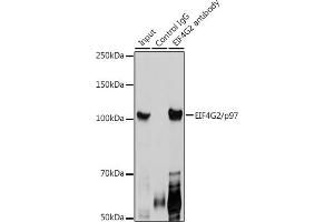 Immunoprecipitation analysis of 300 μg extracts of HeLa cells using 3 μg EIF4G2/p97 antibody (ABIN3016940, ABIN3016941, ABIN3016942 and ABIN6219894).