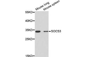 Western blot analysis of extracts of various cell lines, using SOCS3 antibody (ABIN2650956) at 1:3000 dilution.