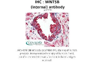 Image no. 2 for anti-Wingless-Type MMTV Integration Site Family, Member 5B (WNT5B) (Internal Region) antibody (ABIN1740832) (WNT5B Antikörper  (Internal Region))