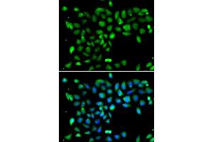 Immunofluorescence analysis of U2OS cells using DYRK2 antibody (ABIN5974219). (DYRK2 Antikörper)