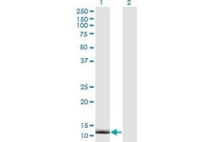 Western Blot analysis of CRABP2 expression in transfected 293T cell line by CRABP2 monoclonal antibody (M01), clone 4F2. (CRABP2 Antikörper  (AA 1-138))