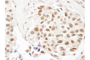 Immunohistochemistry (IHC) image for anti-Fanconi Anemia, Complementation Group D2 (FANCD2) (AA 1401-1451) antibody (ABIN7448562) (FANCD2 Antikörper  (AA 1401-1451))
