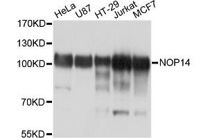 Western blot analysis of extracts of various cell lines, using NOP14 antibody. (Nop14 Antikörper)