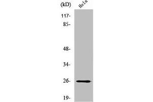 Western Blot analysis of HeLa cells using UMP-CMP Kinase Polyclonal Antibody (Cytidine Monophosphate (UMP-CMP) Kinase 1, Cytosolic (CMPK1) (N-Term) Antikörper)