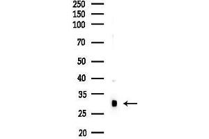anti-N-Acetyltransferase 15 (NAT15) antibody