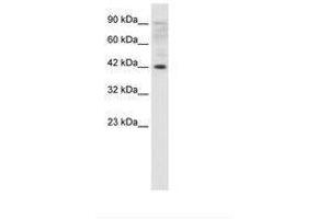 Image no. 1 for anti-Zfp-1 (AA 122-171) antibody (ABIN202319) (Zfp-1 Antikörper  (AA 122-171))